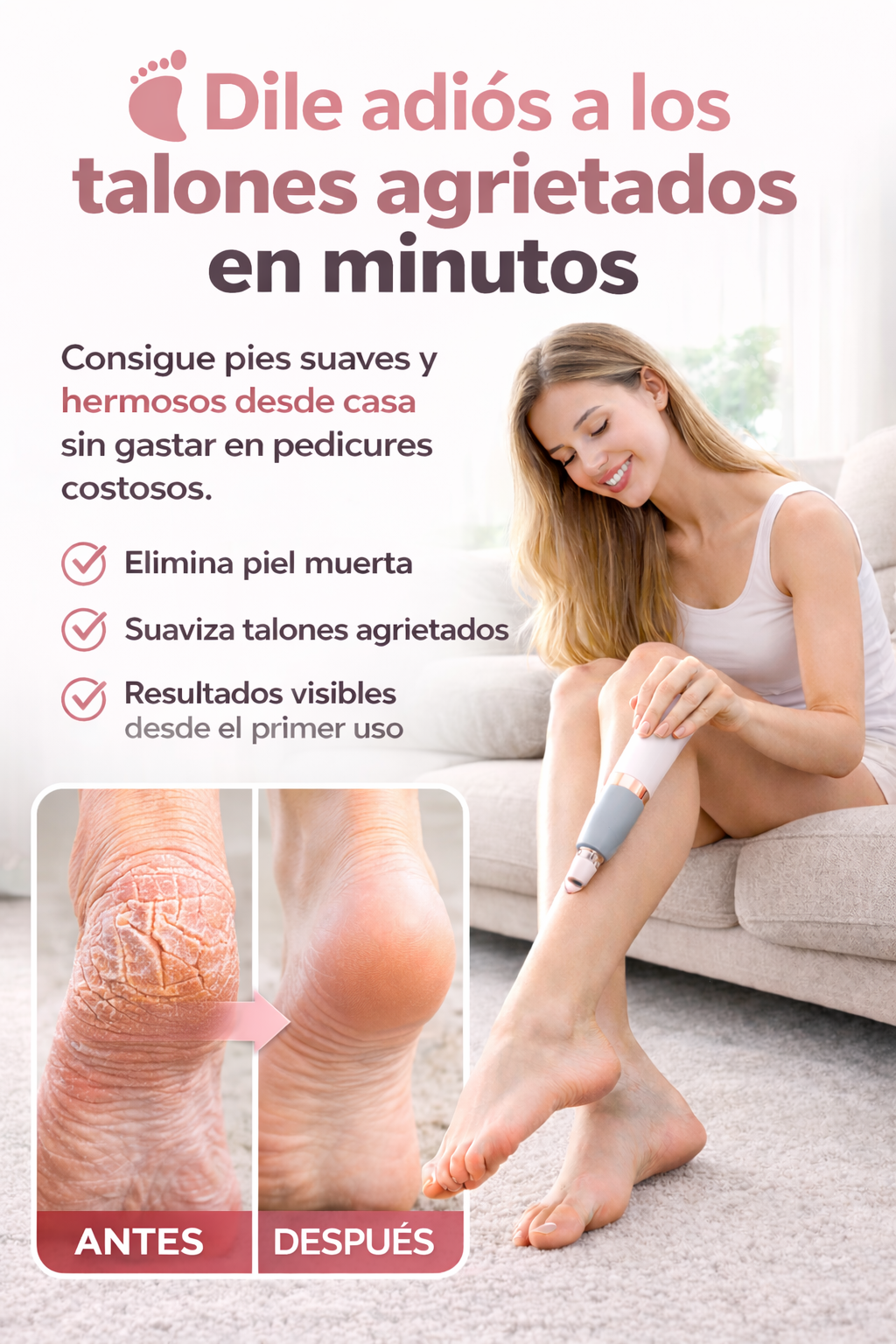 REMOVEDOR DE CALLOS